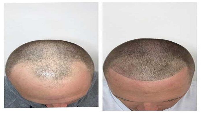 scalp conditions and hair